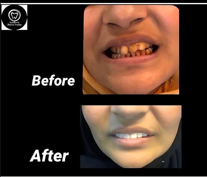patient smiles