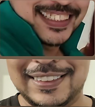 patient smiles