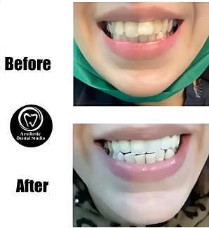 patient smiles