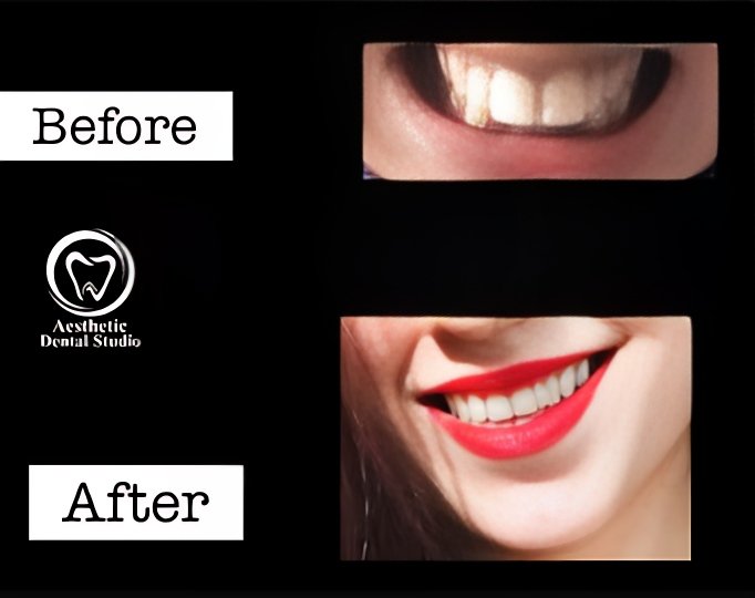 patient smiles