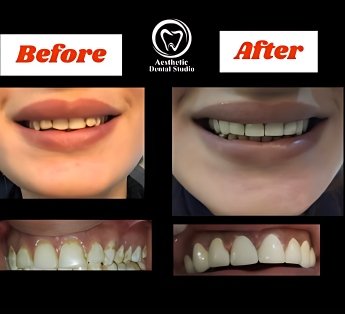 patient smiles
