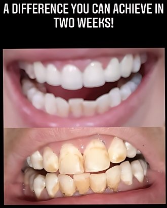 patient smiles