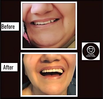 patient smiles