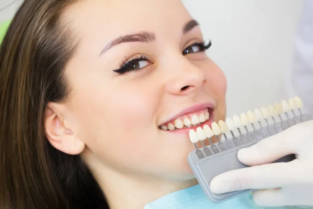 Top 10 Tips to Treat White Spots on Teeth