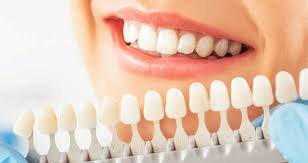 Top 10 Tips to Treat White Spots on Teeth