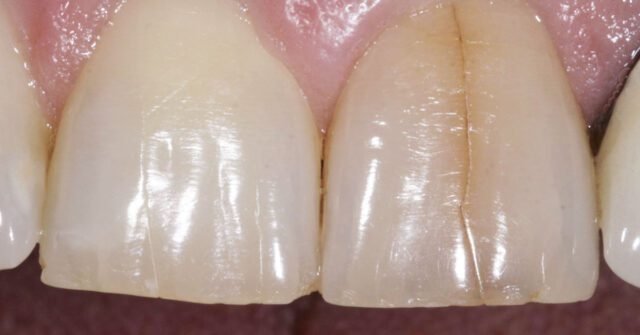 The Importance of Conservative Dental Care